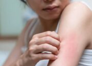 Dampak Mengerikan Kelalaian BU SPAM Batam: Warga Gatal-gatal Akibat Air Tercemar Alga Hijau