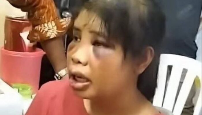 Wajah Lebam dan Luka-Luka: Terungkap Fakta Mengerikan di Balik Video Viral ART Batam