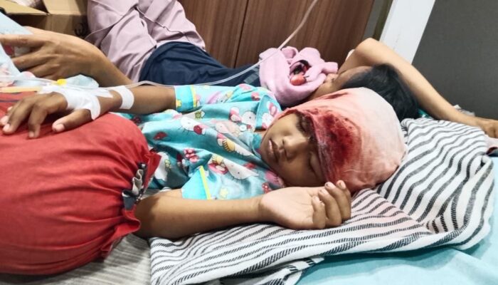 Tragis! Rambut Tersambar Mesin Perahu, Bocah di Natuna Alami Luka Berat di Kepala