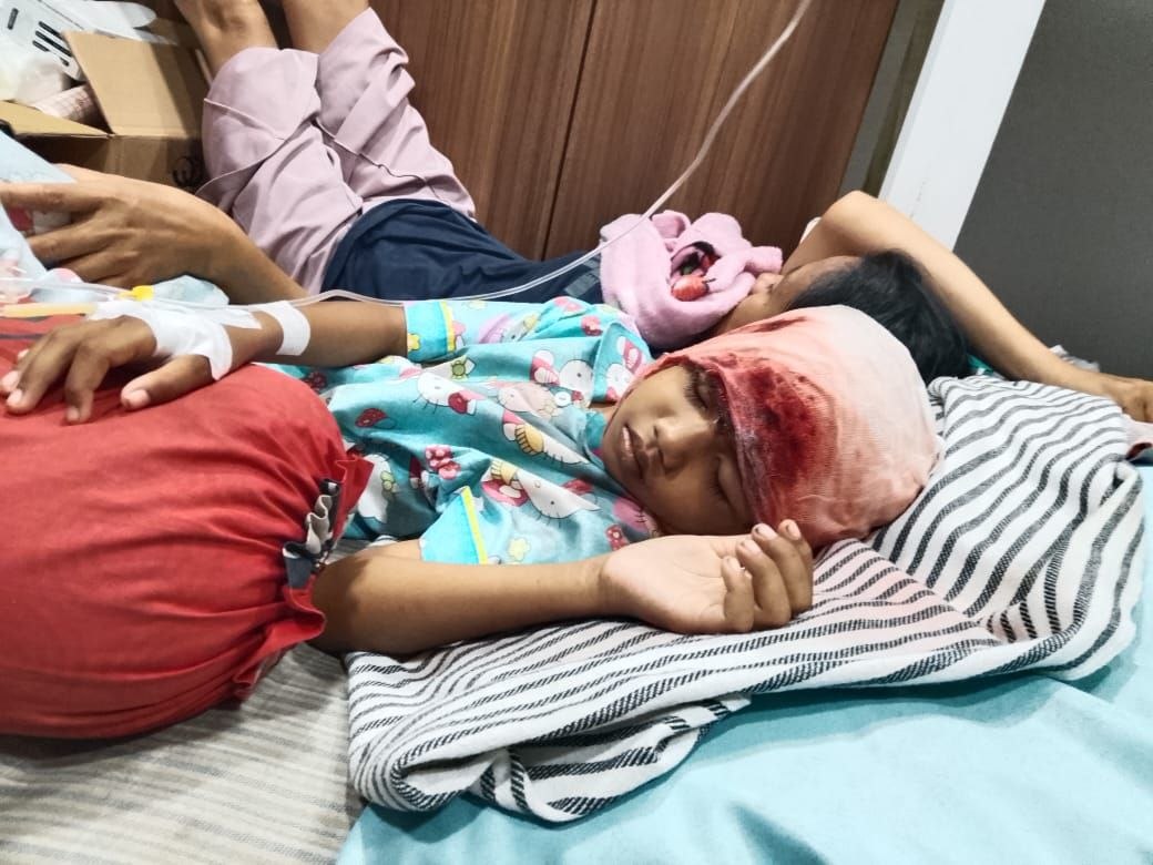 balita di natuna terkena mesin pompong