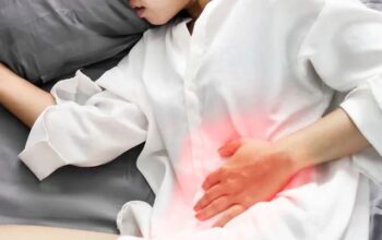 Keracunan-sakit-perut