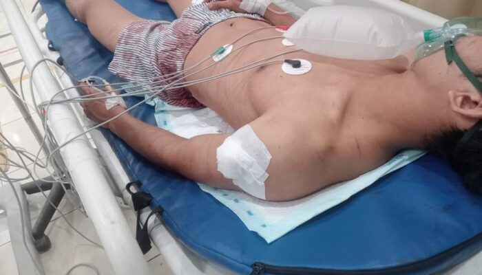 Karyawan Perusahaan Elektronik di Batam Kritis Ditikam Geng Motor di Villa Pesona Asri