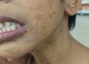 kasus kekejaman ibu tiri terhadap anak di Sagulung Batam.