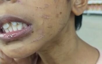 kasus kekejaman ibu tiri terhadap anak di Sagulung Batam.