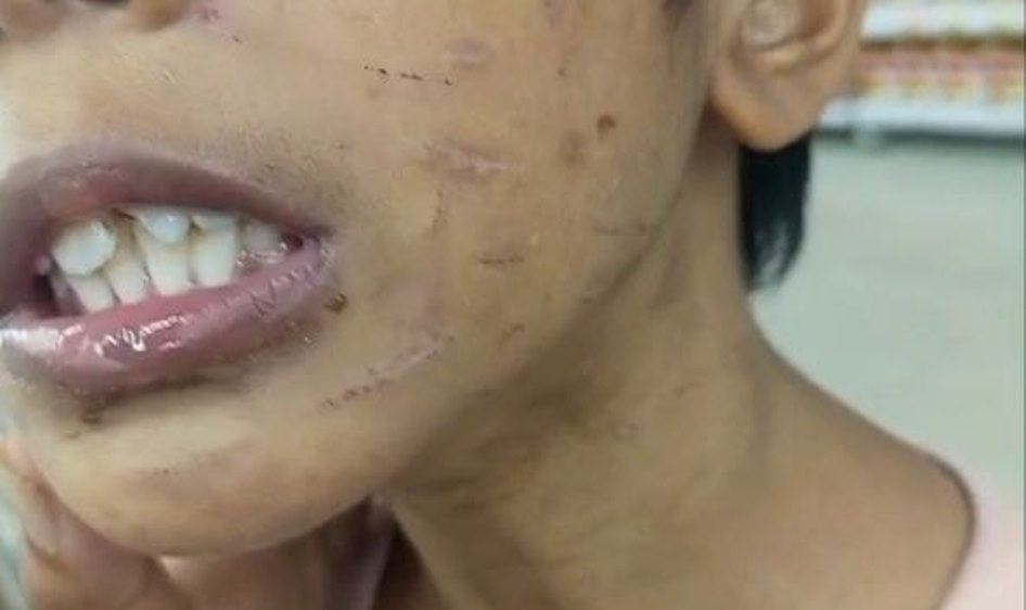 kasus kekejaman ibu tiri terhadap anak di Sagulung Batam.